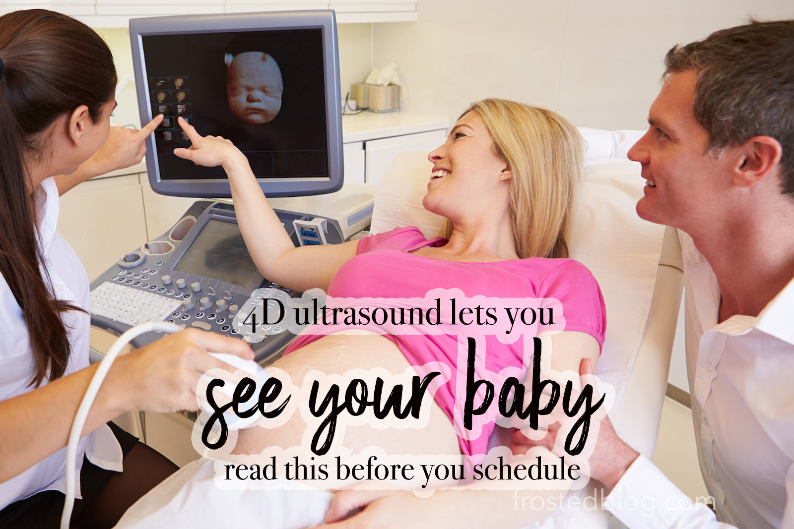 4d Ultrasound Near Me - What to know before you schedule 